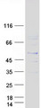 PSMB8 / LMP7 Protein - Purified recombinant protein PSMB8 was analyzed by SDS-PAGE gel and Coomassie Blue Staining