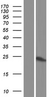 PSMB9 Protein - Western validation with an anti-DDK antibody * L: Control HEK293 lysate R: Over-expression lysate