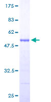 PSMB9 Protein - 12.5% SDS-PAGE of human PSMB9 stained with Coomassie Blue