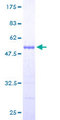 PSMB9 Protein - 12.5% SDS-PAGE of human PSMB9 stained with Coomassie Blue