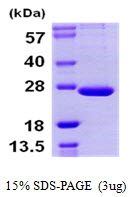 PSMB9 Protein