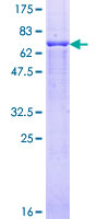 PSMC2 / RPT1 Protein - 12.5% SDS-PAGE of human PSMC2 stained with Coomassie Blue