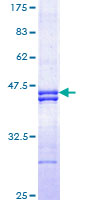 PSMC3 Protein - 12.5% SDS-PAGE Stained with Coomassie Blue.