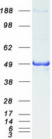 PSMC3 Protein - Purified recombinant protein PSMC3 was analyzed by SDS-PAGE gel and Coomassie Blue Staining