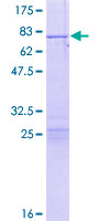PSMC5 / SUG1 Protein - 12.5% SDS-PAGE of human PSMC5 stained with Coomassie Blue