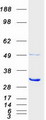 PSMC5 / SUG1 Protein - Purified recombinant protein PSMC5 was analyzed by SDS-PAGE gel and Coomassie Blue Staining