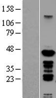 PSMC6 Protein - Western validation with an anti-DDK antibody * L: Control HEK293 lysate R: Over-expression lysate