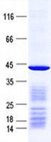 PSMC6 Protein