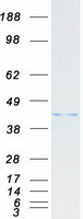 PSMC6 Protein - Purified recombinant protein PSMC6 was analyzed by SDS-PAGE gel and Coomassie Blue Staining