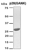 PSMD10 / Gankyrin Protein