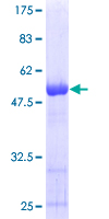 PSMD10 / Gankyrin Protein - 12.5% SDS-PAGE of human PSMD10 stained with Coomassie Blue