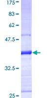 PSMD10 / Gankyrin Protein - 12.5% SDS-PAGE Stained with Coomassie Blue.