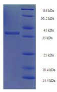 PSMD10 / Gankyrin Protein