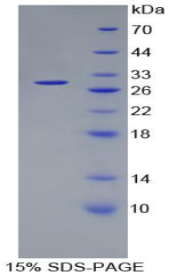 PSMD10 / Gankyrin Protein - Recombinant Proteasome 26S Subunit, Non ATPase 10 By SDS-PAGE