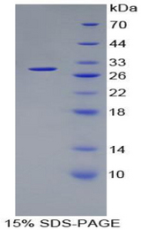 PSMD10 / Gankyrin Protein - Recombinant Proteasome 26S Subunit, Non ATPase 10 By SDS-PAGE