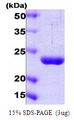 PSMD10 / Gankyrin Protein