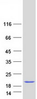 PSMD10 / Gankyrin Protein - Purified recombinant protein PSMD10 was analyzed by SDS-PAGE gel and Coomassie Blue Staining