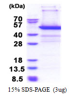 PSMD11 Protein