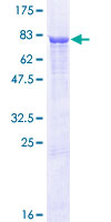 PSMD12 / Rpn5 Protein - 12.5% SDS-PAGE of human PSMD12 stained with Coomassie Blue