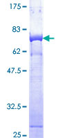 PSMD13 Protein - 12.5% SDS-PAGE of human PSMD13 stained with Coomassie Blue