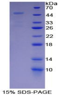 PSMD13 Protein - Recombinant Proteasome 26S Subunit, Non ATPase 13 By SDS-PAGE