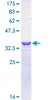 PSMD14 Protein - 12.5% SDS-PAGE of human PSMD14 stained with Coomassie Blue
