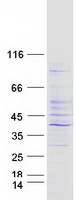 PSMD14 Protein - Purified recombinant protein PSMD14 was analyzed by SDS-PAGE gel and Coomassie Blue Staining
