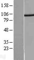PSMD2 Protein - Western validation with an anti-DDK antibody * L: Control HEK293 lysate R: Over-expression lysate