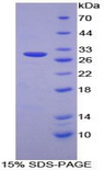 PSMD2 Protein - Recombinant Proteasome 26S Subunit, Non ATPase 2 By SDS-PAGE