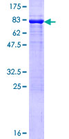 PSMD4 / RPN10 Protein - 12.5% SDS-PAGE of human PSMD4 stained with Coomassie Blue