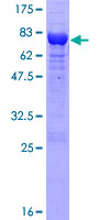 PSMD5 Protein - 12.5% SDS-PAGE of human PSMD5 stained with Coomassie Blue