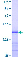 PSMD5 Protein - 12.5% SDS-PAGE Stained with Coomassie Blue.