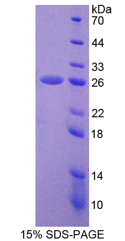 PSMD5 Protein - Recombinant  Proteasome 26S Subunit, Non ATPase 5 By SDS-PAGE