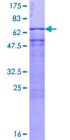 PSMD6 Protein - 12.5% SDS-PAGE of human PSMD6 stained with Coomassie Blue