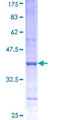 PSMD6 Protein - 12.5% SDS-PAGE Stained with Coomassie Blue.