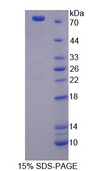 PSMD6 Protein - Recombinant Proteasome 26S Subunit, Non ATPase 6 By SDS-PAGE