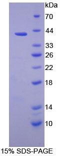 PSMD7 / MOV34 Protein - Recombinant Proteasome 26S Subunit, Non ATPase 7 By SDS-PAGE