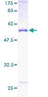 PSMD9 / 26S Proteasome Protein - 12.5% SDS-PAGE of human PSMD9 stained with Coomassie Blue