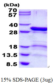 PSMD9 / 26S Proteasome Protein