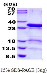 PSMD9 / 26S Proteasome Protein