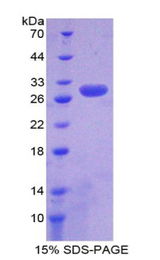 PSMD9 / 26S Proteasome Protein - Recombinant Proteasome 26S Subunit, Non ATPase 9 By SDS-PAGE