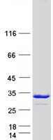 PSMD9 / 26S Proteasome Protein - Purified recombinant protein PSMD9 was analyzed by SDS-PAGE gel and Coomassie Blue Staining