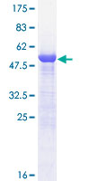 PSME1 Protein - 12.5% SDS-PAGE of human PSME1 stained with Coomassie Blue