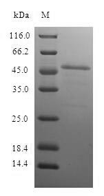 PSME1 Protein - (Tris-Glycine gel) Discontinuous SDS-PAGE (reduced) with 5% enrichment gel and 15% separation gel.