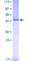 PSME2 Protein - 12.5% SDS-PAGE of human PSME2 stained with Coomassie Blue