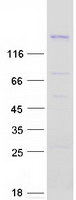 PSME4 / PA200 Protein - Purified recombinant protein PSME4 was analyzed by SDS-PAGE gel and Coomassie Blue Staining