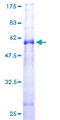 PSMG1 Protein - 12.5% SDS-PAGE of human DSCR2 stained with Coomassie Blue
