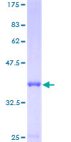 PSMG3 Protein - 12.5% SDS-PAGE of human MGC10911 stained with Coomassie Blue