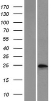 PSPH Protein - Western validation with an anti-DDK antibody * L: Control HEK293 lysate R: Over-expression lysate