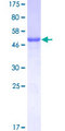 PSPH Protein - 12.5% SDS-PAGE of human PSPH stained with Coomassie Blue